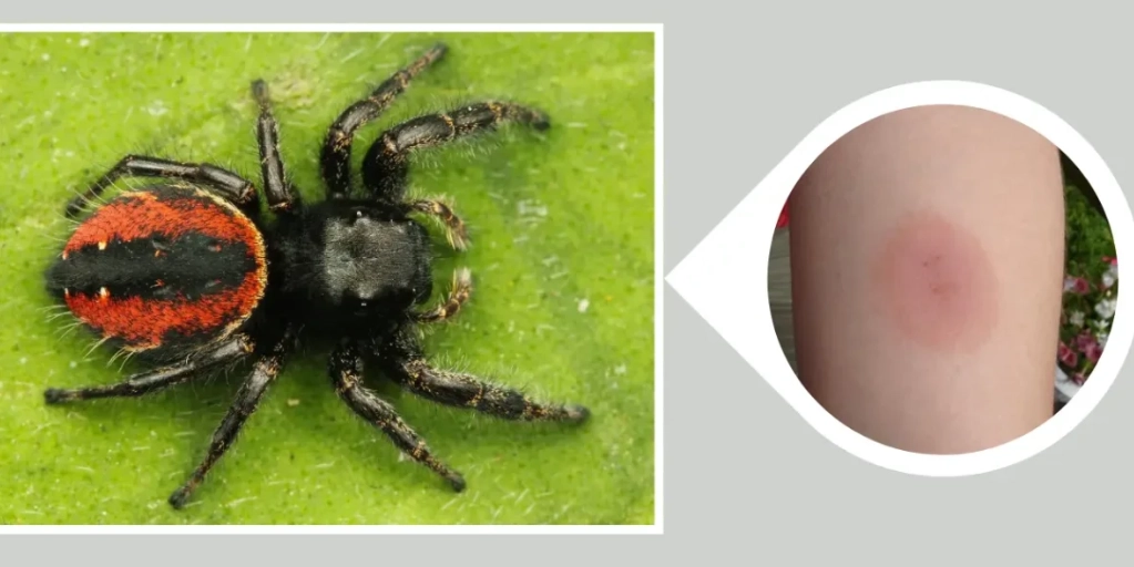 are jumping spiders dangerous